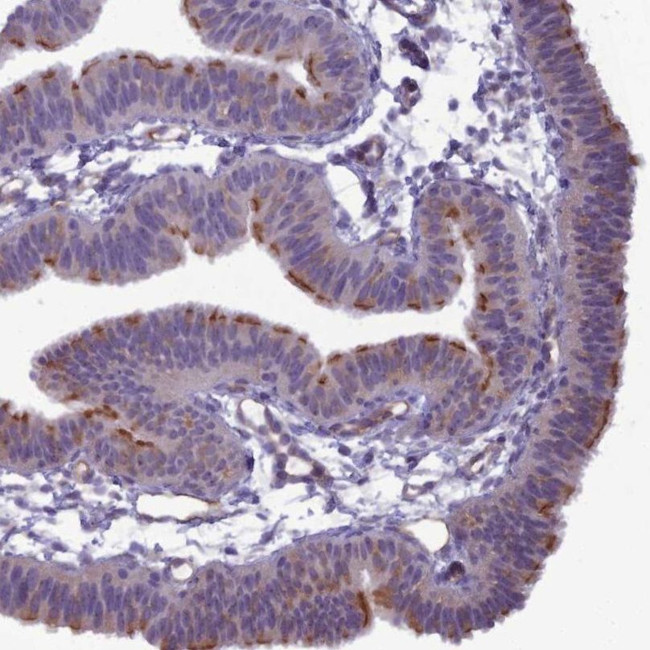 BBS7 Antibody in Immunohistochemistry (IHC)