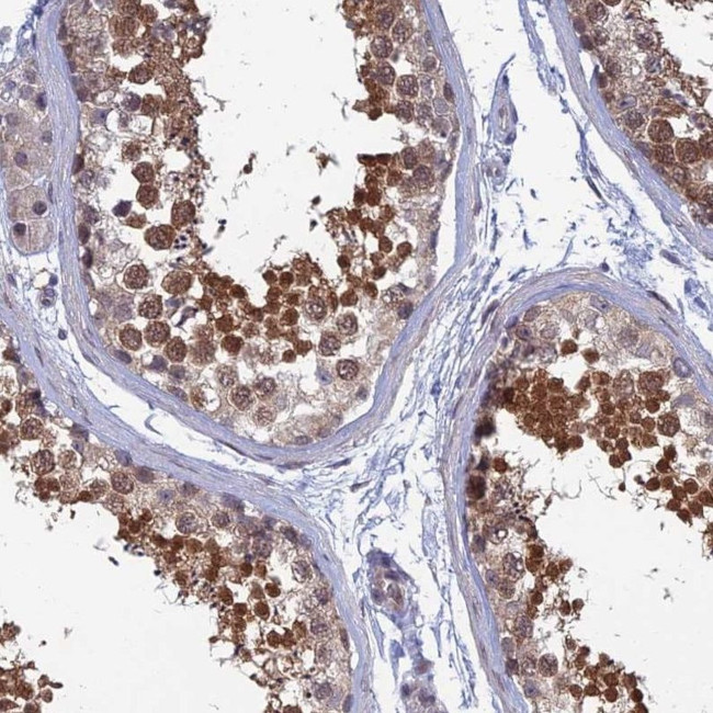 SRA1 Antibody in Immunohistochemistry (IHC)