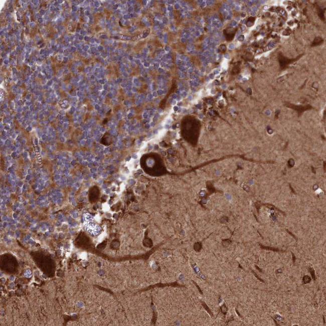 SPOCK2 Antibody in Immunohistochemistry (IHC)