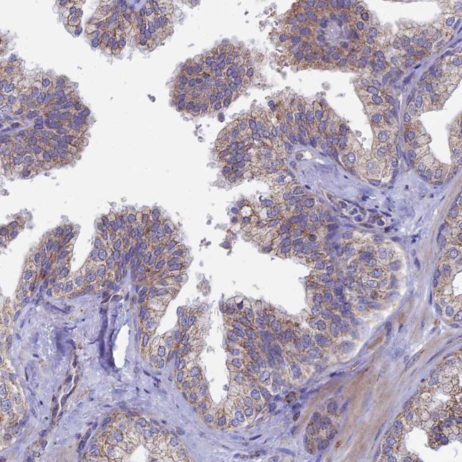 SPOCK2 Antibody in Immunohistochemistry (IHC)