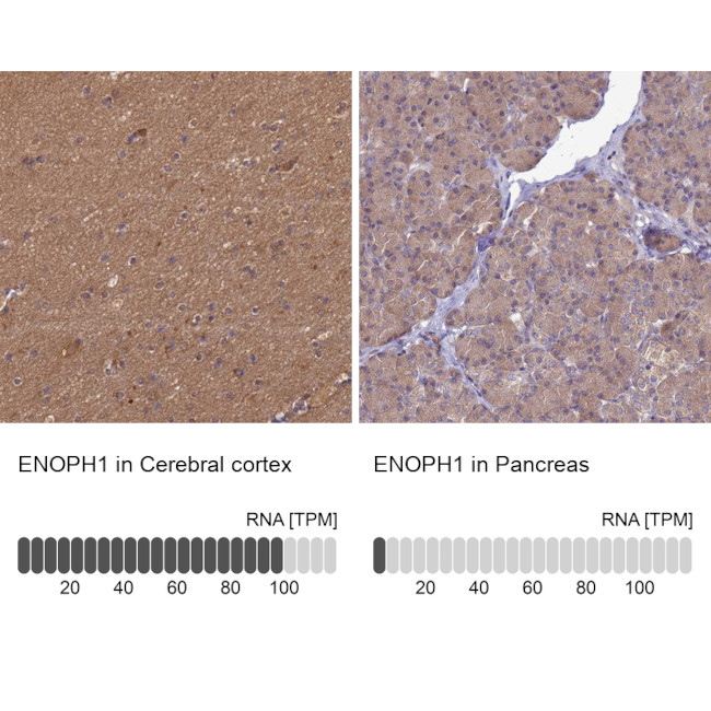 ENOPH1 Antibody in Immunohistochemistry (IHC)