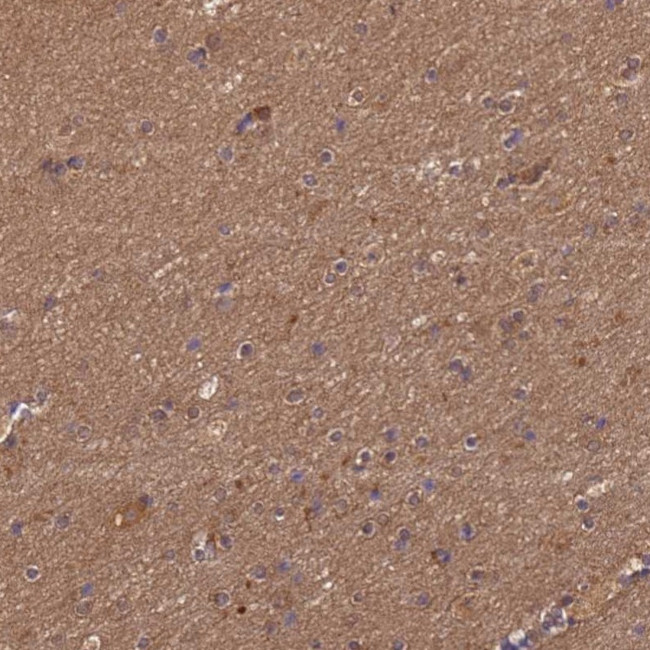 ENOPH1 Antibody in Immunohistochemistry (IHC)