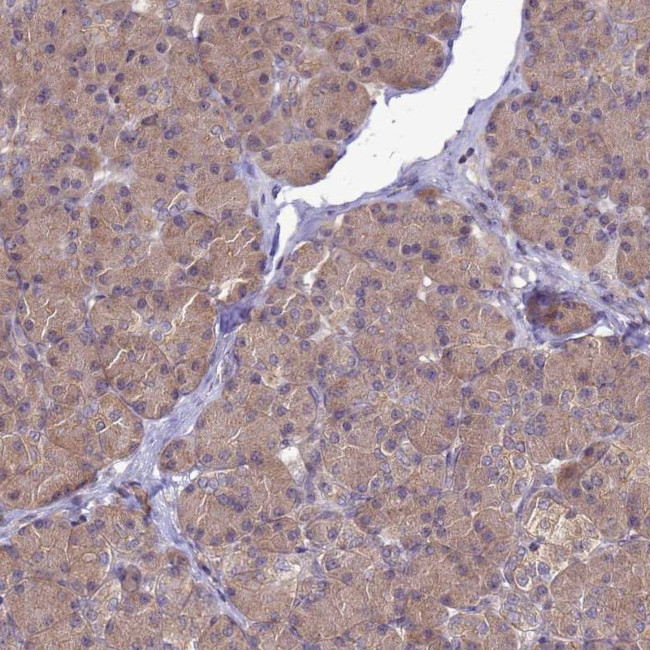 ENOPH1 Antibody in Immunohistochemistry (IHC)