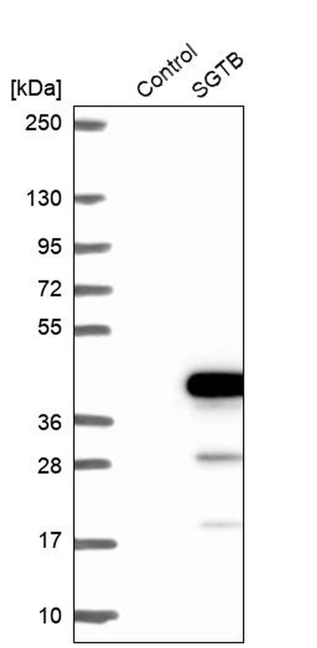 SGTB Antibody in Western Blot (WB)