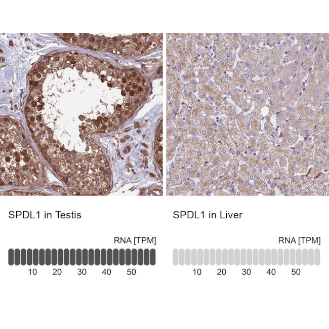 SPDL1 Antibody in Immunohistochemistry (IHC)