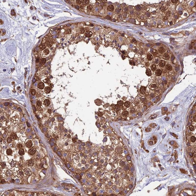 SPDL1 Antibody in Immunohistochemistry (IHC)