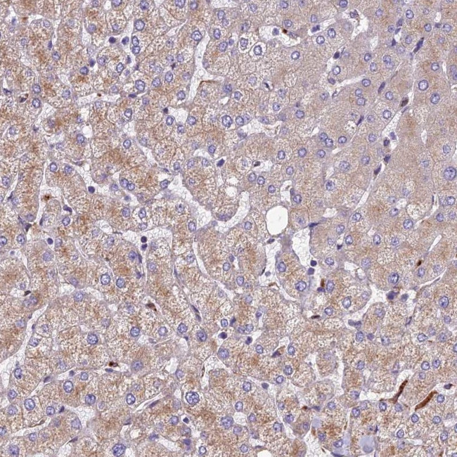 SPDL1 Antibody in Immunohistochemistry (IHC)