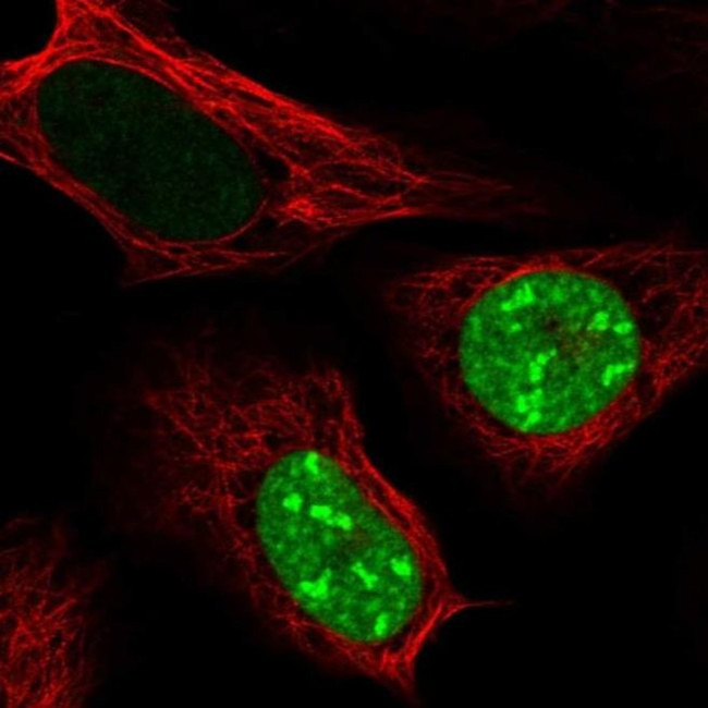 CT45A Antibody in Immunocytochemistry (ICC/IF)