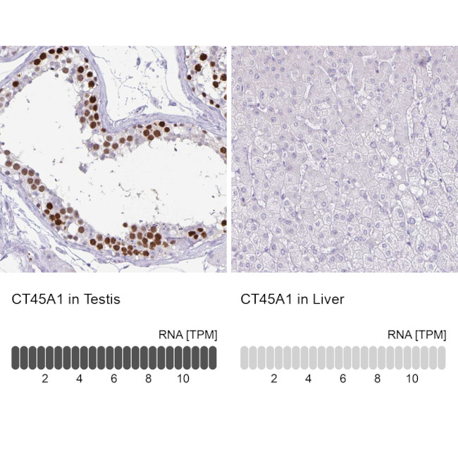 CT45A Antibody in Immunohistochemistry (IHC)