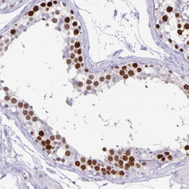 CT45A Antibody in Immunohistochemistry (IHC)