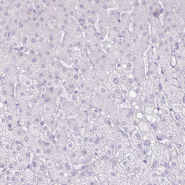 CT45A Antibody in Immunohistochemistry (IHC)