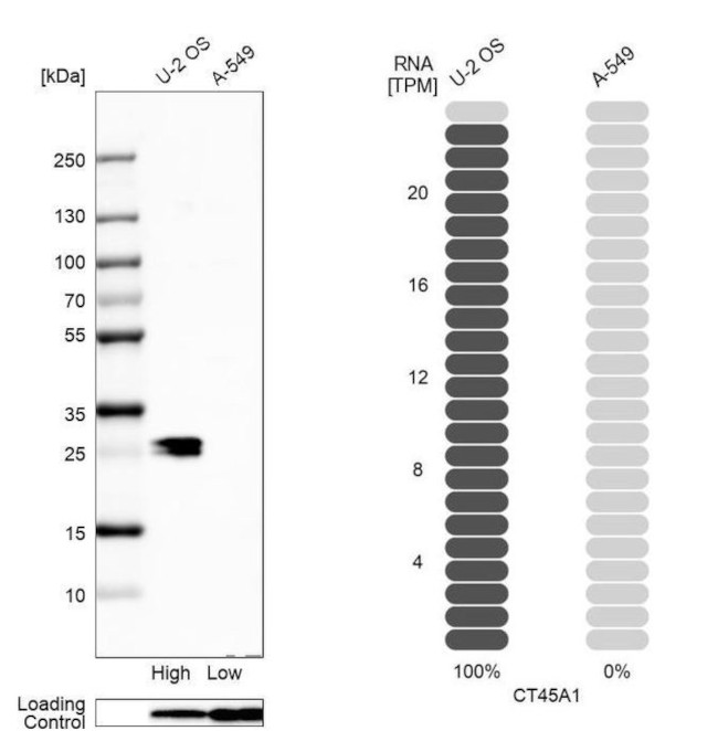 CT45A Antibody