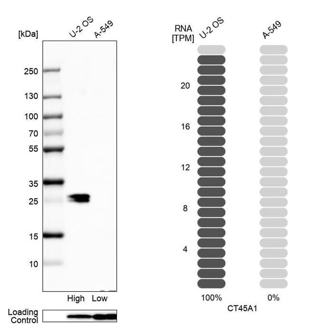 CT45A Antibody in Western Blot (WB)