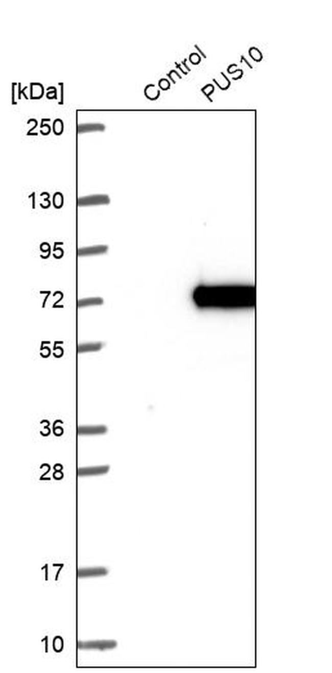 PUS10 Antibody in Western Blot (WB)