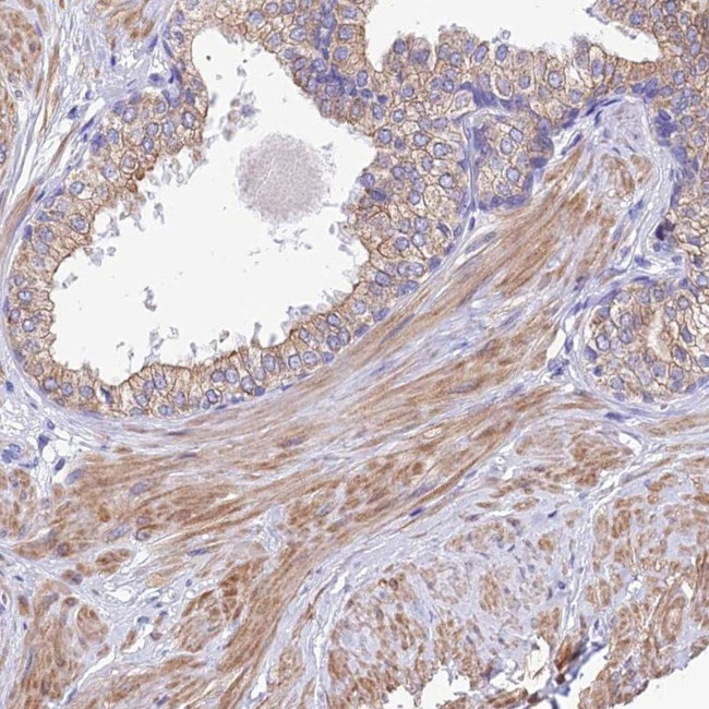 GLRA4 Antibody in Immunohistochemistry (IHC)