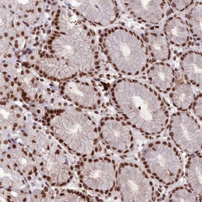 SH3RF3 Antibody in Immunohistochemistry (IHC)