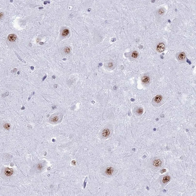 U2AF1 Antibody in Immunohistochemistry (IHC)