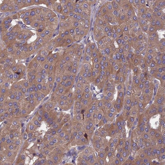 OPA3 Antibody in Immunohistochemistry (IHC)