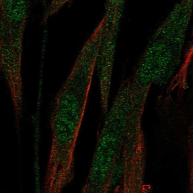 ABCA8 Antibody in Immunocytochemistry (ICC/IF)