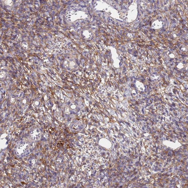 ABCA8 Antibody in Immunohistochemistry (IHC)