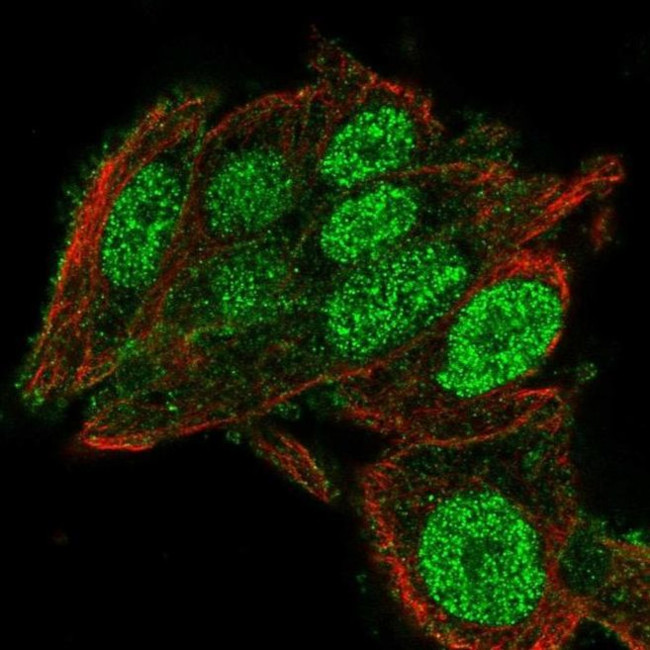 C2orf72 Antibody in Immunocytochemistry (ICC/IF)