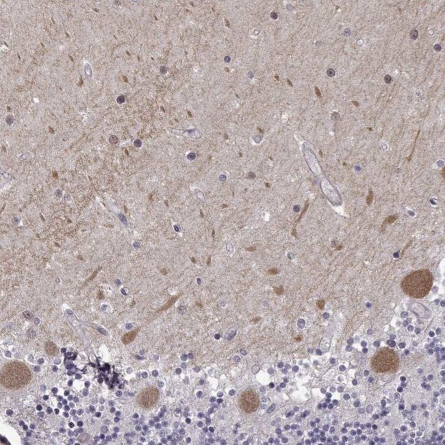 EIF4E1B Antibody in Immunohistochemistry (IHC)