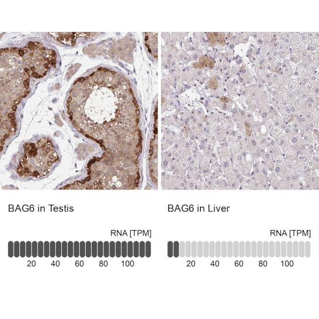 BAG6 Antibody in Immunohistochemistry (IHC)