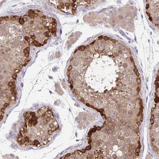 BAG6 Antibody in Immunohistochemistry (IHC)