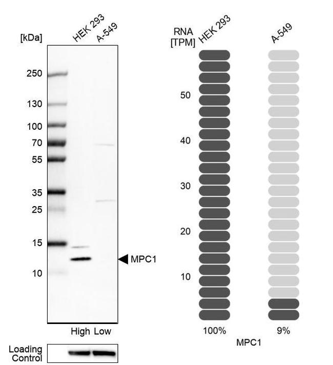 BRP44L Antibody in Western Blot (WB)