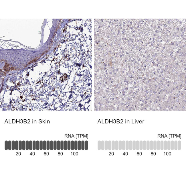 ALDH3B2 Antibody in Immunohistochemistry (IHC)