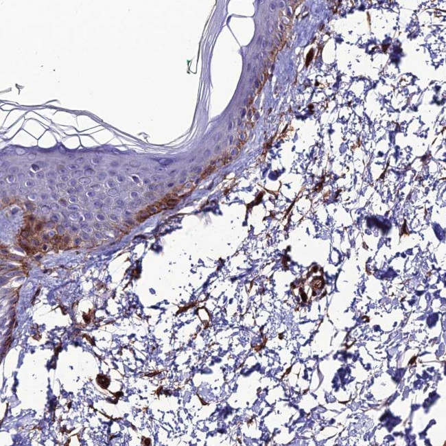 ALDH3B2 Antibody in Immunohistochemistry (IHC)