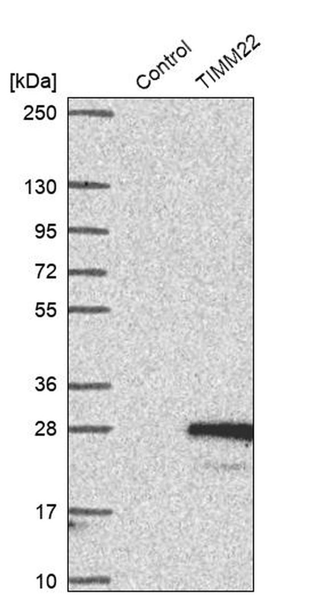 TIMM22 Antibody in Western Blot (WB)