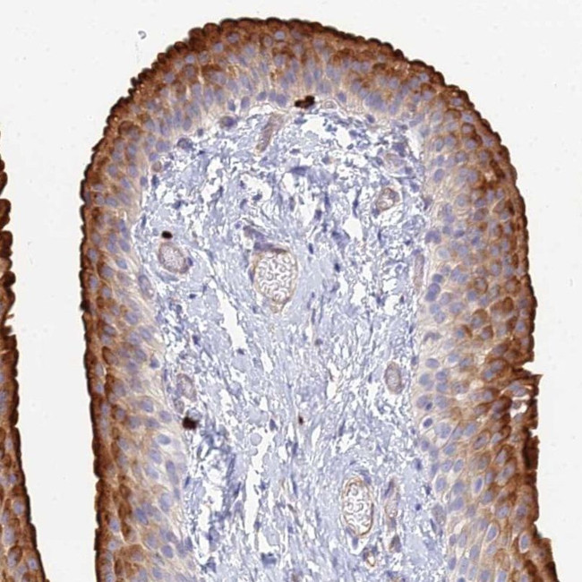 VAT1 Antibody in Immunohistochemistry (IHC)