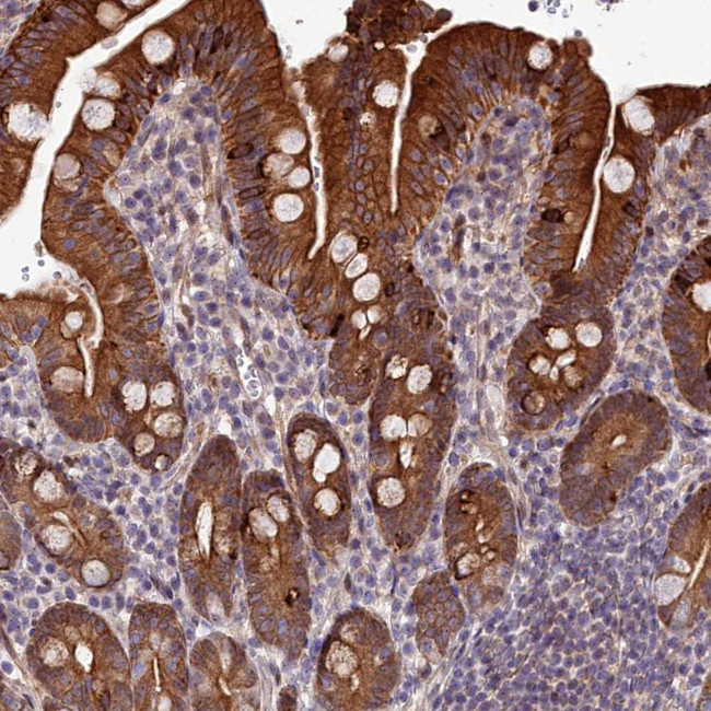 ABCB8 Antibody in Immunohistochemistry (IHC)