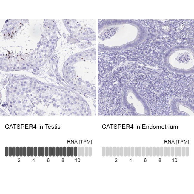 CATSPER4 Antibody in Immunohistochemistry (IHC)