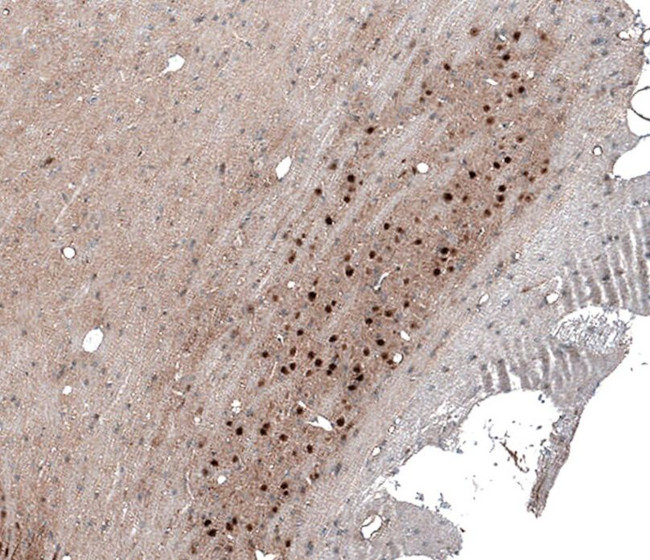 SCRT1 Antibody in Immunohistochemistry (IHC)