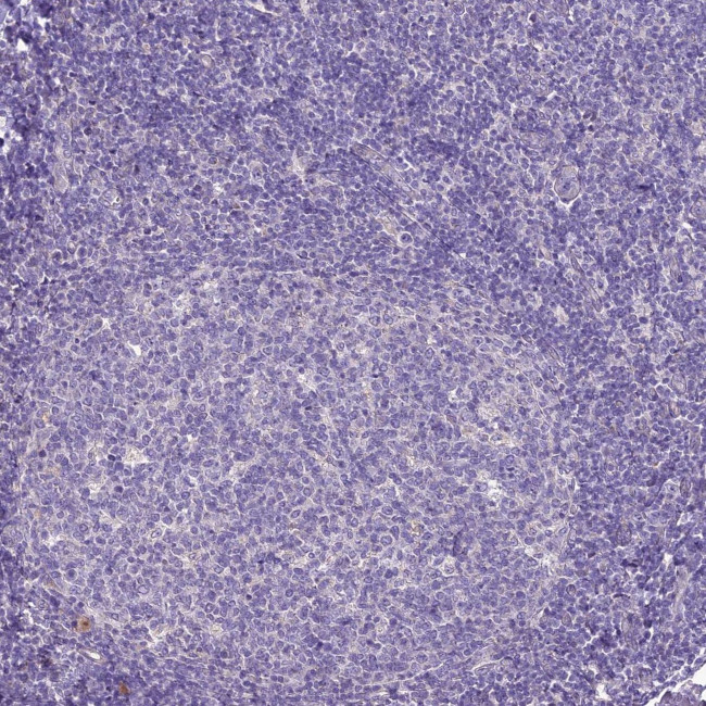 SCRT1 Antibody in Immunohistochemistry (IHC)