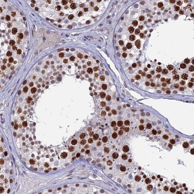 TAF9B Antibody in Immunohistochemistry (IHC)