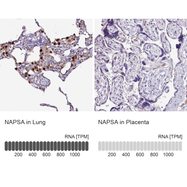 NAPSA Antibody in Immunohistochemistry (IHC)