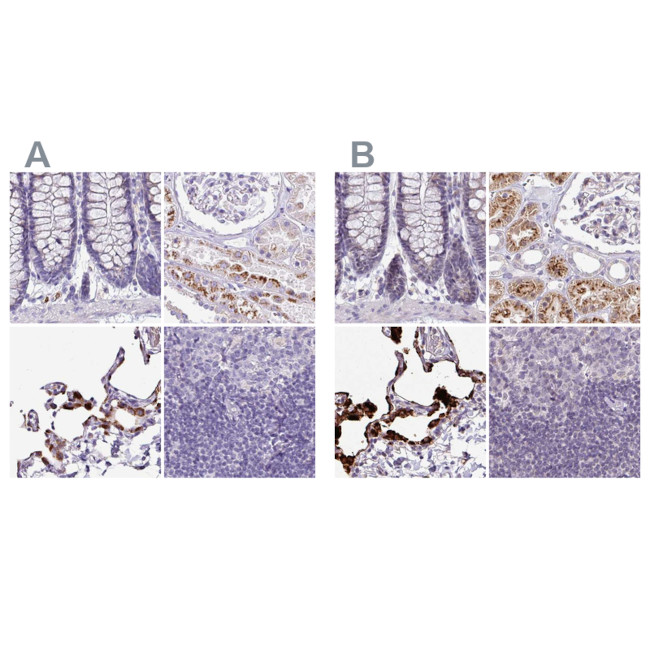 NAPSA Antibody in Immunohistochemistry (IHC)