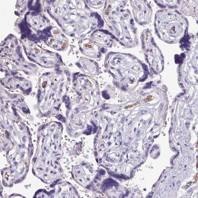 NAPSA Antibody in Immunohistochemistry (IHC)