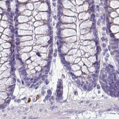 NAPSA Antibody in Immunohistochemistry (IHC)