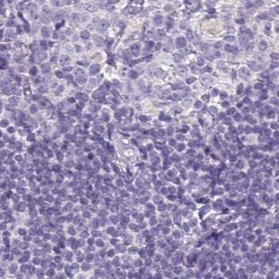 NAPSA Antibody in Immunohistochemistry (IHC)