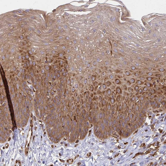 WAVE2 Antibody in Immunohistochemistry (IHC)