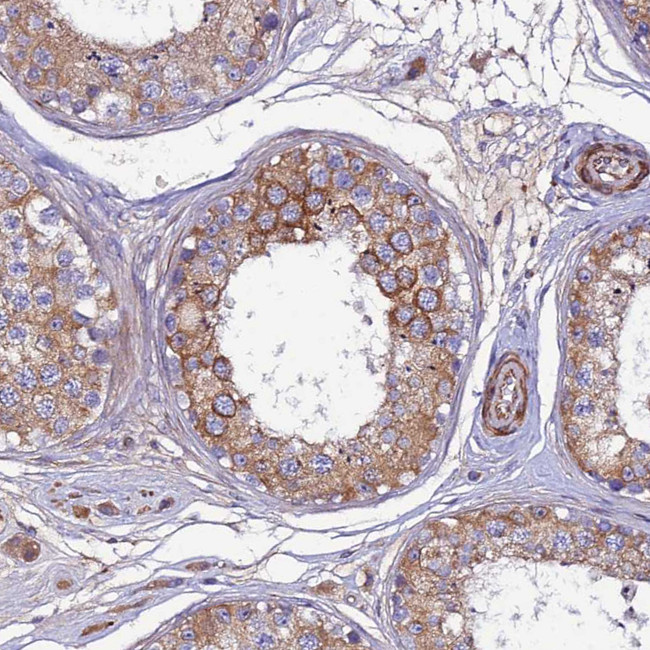 ARMER Antibody in Immunohistochemistry (IHC)