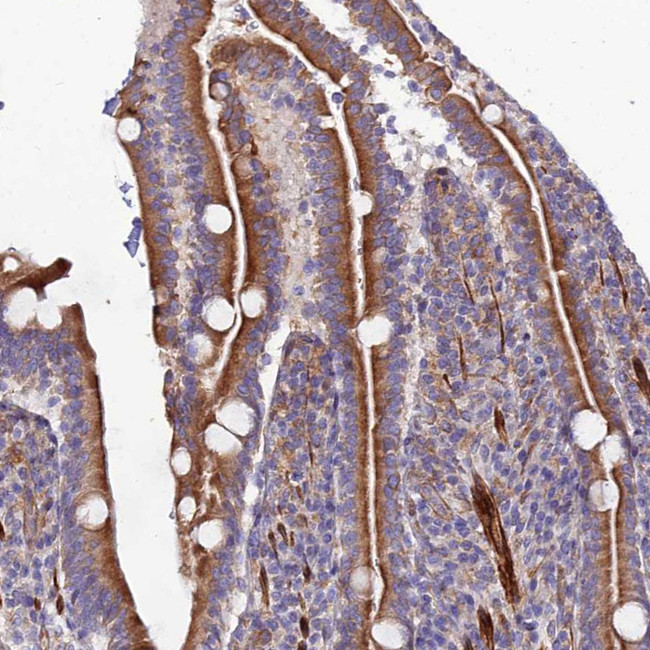 ARMER Antibody in Immunohistochemistry (IHC)