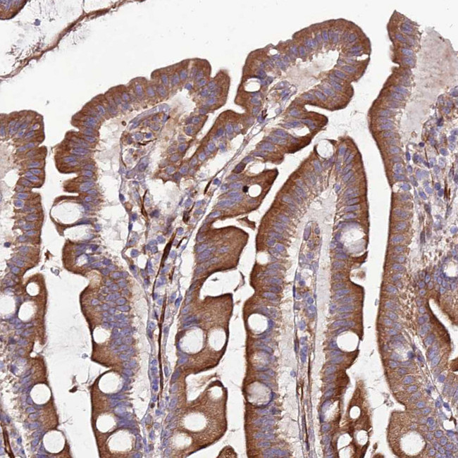 ARMER Antibody in Immunohistochemistry (IHC)