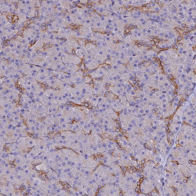 ARMER Antibody in Immunohistochemistry (IHC)