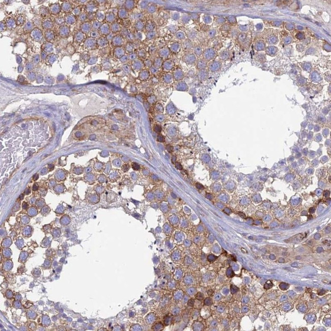 TXLNA Antibody in Immunohistochemistry (IHC)