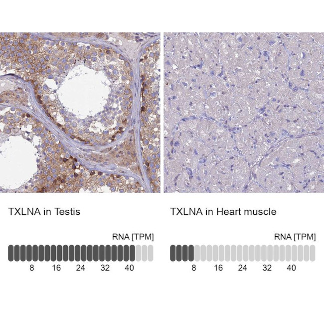 TXLNA Antibody